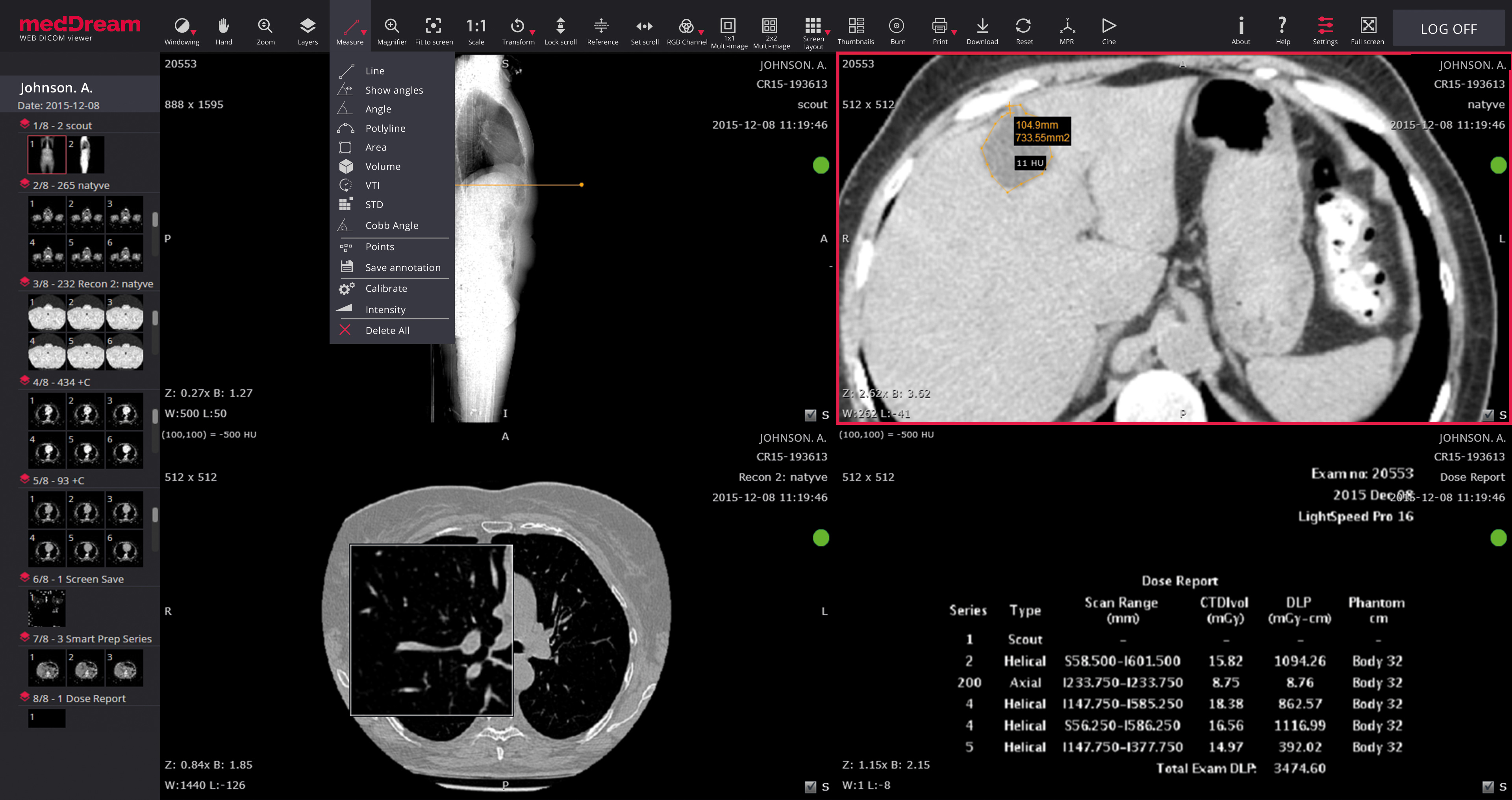 MedDream DICOM Viewer radiology